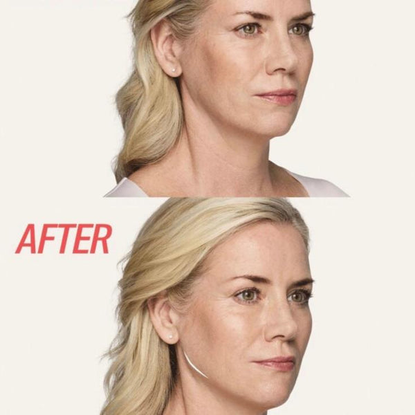 Lower Face Injectable Package